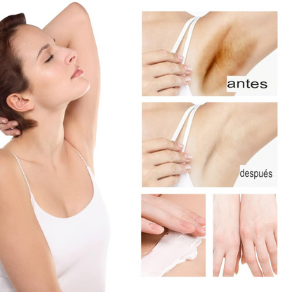 Crema Blanqueadora