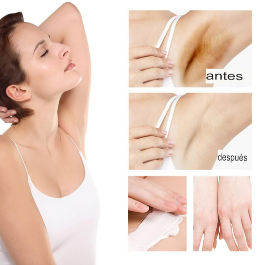 Crema Blanqueadora